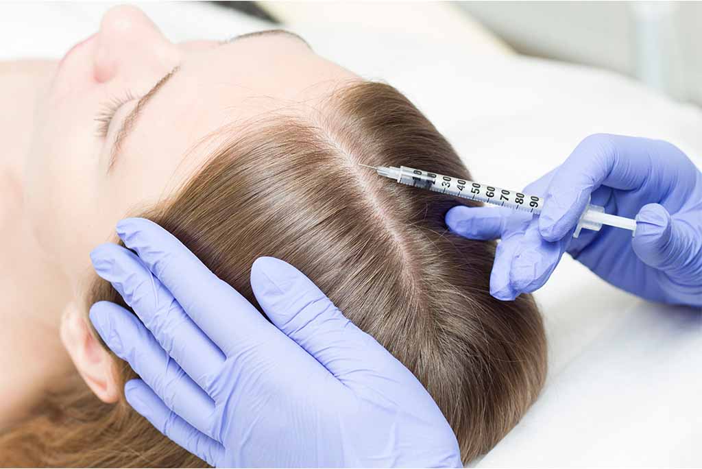 Intradermocapilar